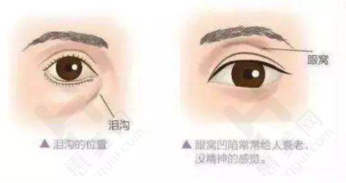 部分项目实例展示意义