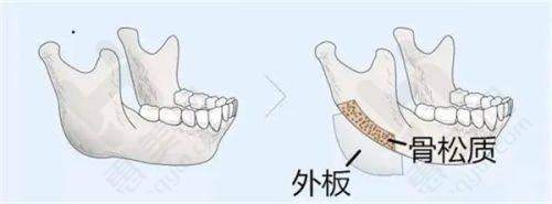 交通便利性