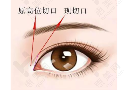 顾客选择蚌埠华美整形美容门诊部的原因