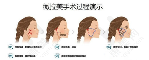 医院特色项目
