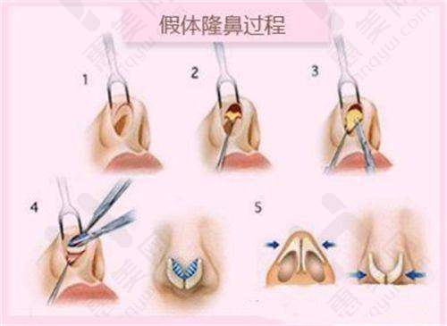 特色项目介绍