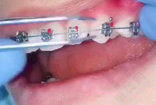 患者体验与评价