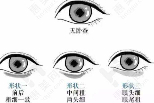 唐山光子嫩肤价格影响因素