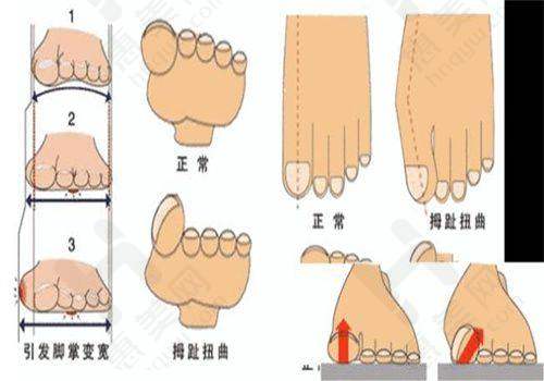 临沂私立机构光子嫩肤价格情况