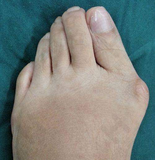 影响盐城光子嫩肤价格的因素