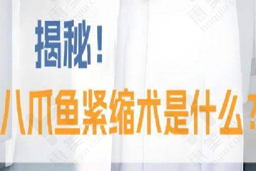 总结与选择指引