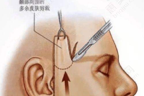 常德市第一人民医院光子嫩肤价格与其他项目对比