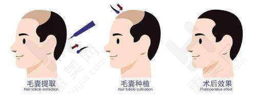 漳州芗城柏思娅医疗美容门诊部光子嫩肤价格揭秘