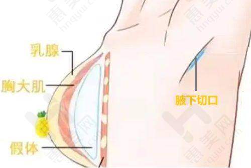 运城光子嫩肤的选择建议