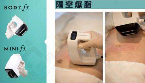 光子嫩肤的魅力
