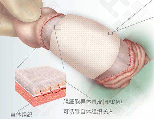 国有三等甲综合医院皮肤科优势