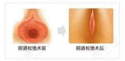 乐山不同医院光子嫩肤价格情况