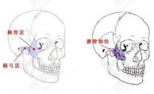 常德市第一人民医院光子嫩肤的真实体验与成效