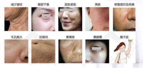 佛山市第二人民医院皮肤科特色突出