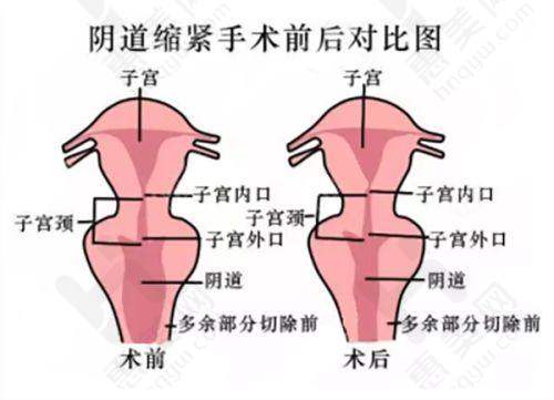 如何选择郑州皮肤科医院
