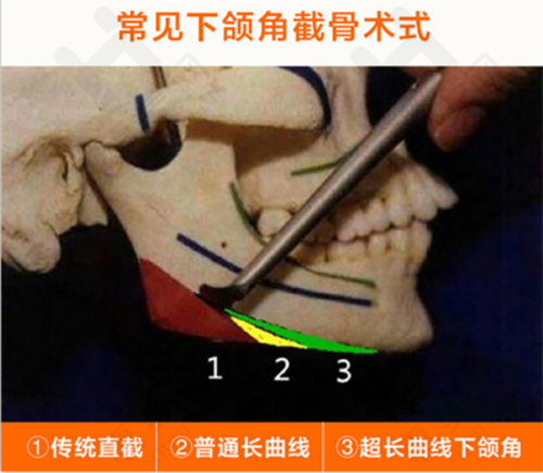 福州部分皮肤科相关医院