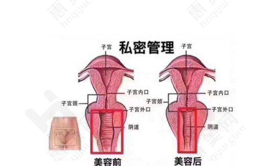 东莞做鼻子好的医院及价格详情
