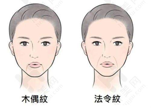 在线问诊注意事项