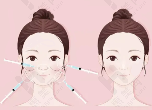 长春做鼻子好的医院和医生推荐