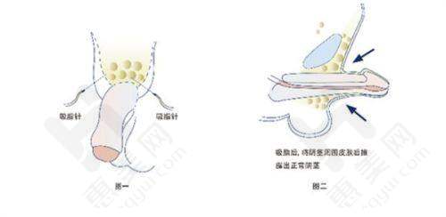 东莞美立方整形美容医院详细剖析