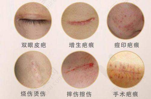 选择皮肤科医院需多方面考量