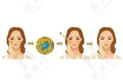 长沙艺星整形医院皮肤科医生