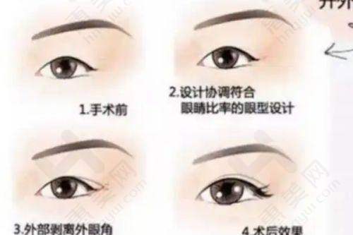 适用部位及用量有讲究