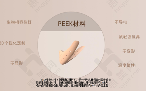 7D聚拉提原理与优势显著