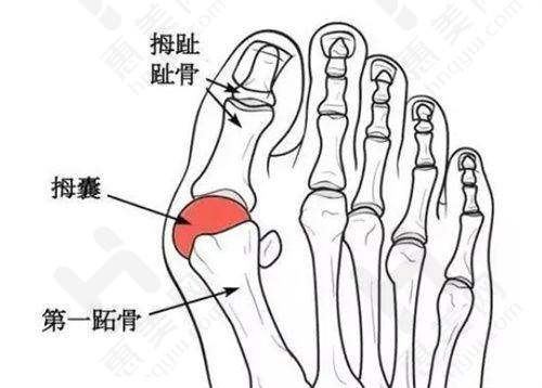 切眉/提眉术价格优势