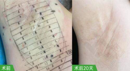 南京医科大学友谊整形外科医院常州分院的实力