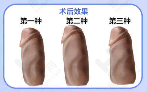 实力强大的医生团队