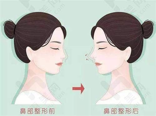 透明收费合理消费
