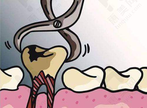 口腔项目价格情况