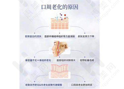 填充眉弓成效显著