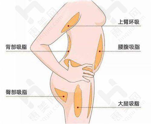 邢台伊美整形医院植发相关情况