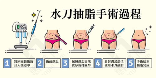 术后注意要牢记
