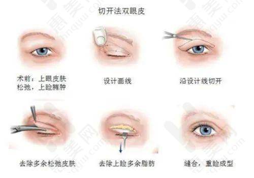连锁背景增添保护