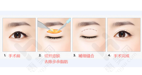 英诺紧致素对抗衰老问题
