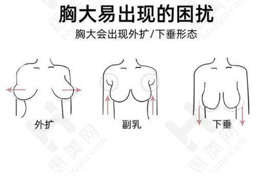 不同规格的差异与选择