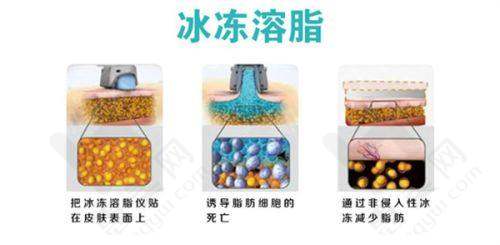 舟山艾美医疗美容疤痕针常见疑问解答