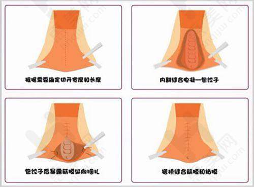 多样项目与合理价格
