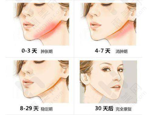 毛囊检测价格情况