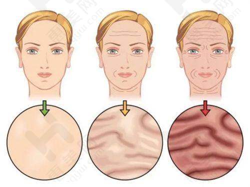 注射 BOTOX - 瘦脸针的注意事项之术后护理