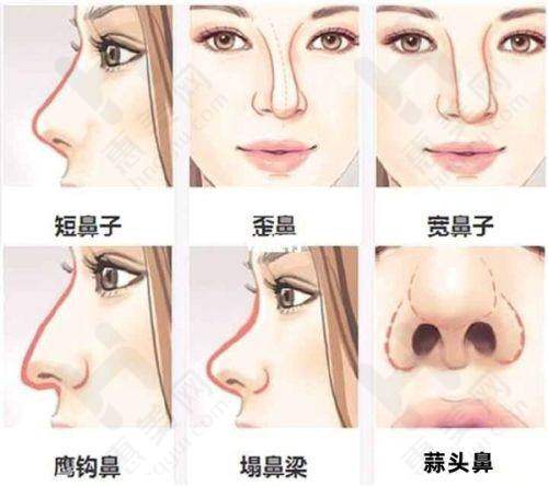 选择建议要牢记