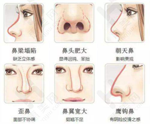 开封乾颜整形美容医院 BOTOX - 瘦脸针优势之优质产品供应