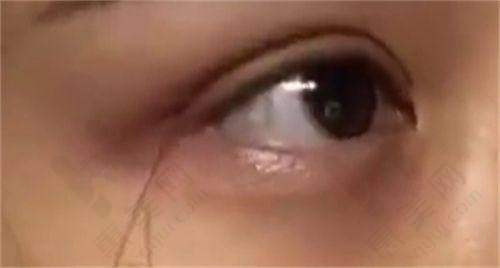 济南美莲整形医院:精细操作显优势