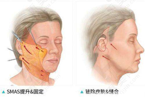 擅长项目丰富多样