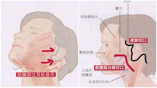 优惠活动特别诱人