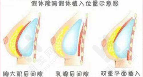 芜湖壹加壹医疗美容:多样手术方式可选