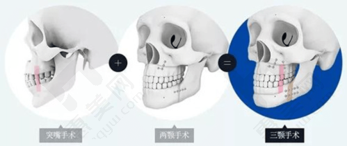 上海第九人民医院谢峰：沟通与技术兼备